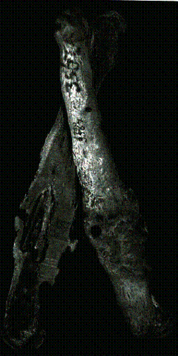 cross section left femur