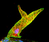 itb1 confocal img